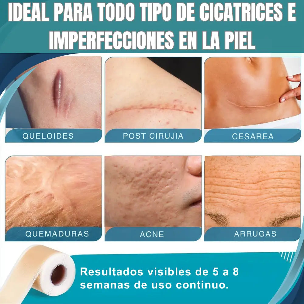 Silicone Scar Sheets® Cinta de Silicona Cicatrizante - Marcas invisibles, Piel Uniforme 👣