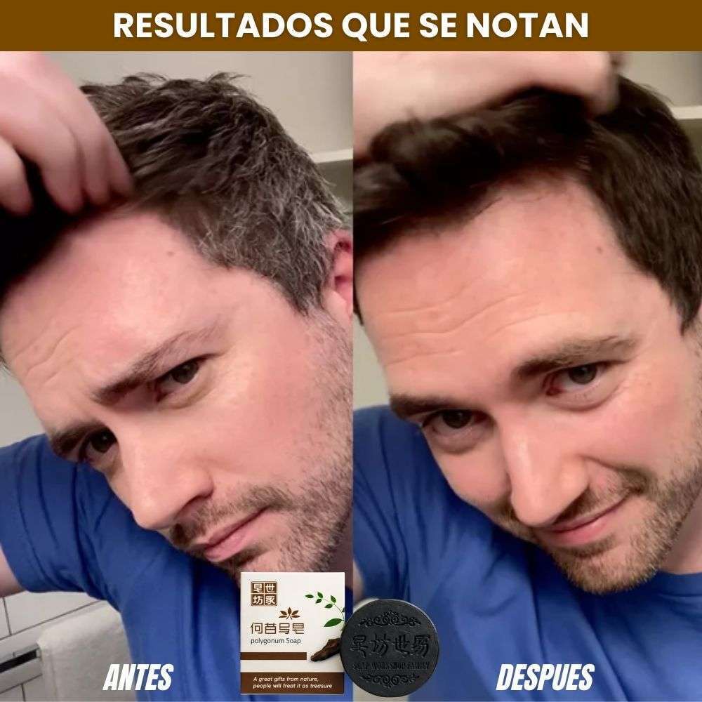Polygonum Soap®🫚Shampoo en barra Anticanas: Paga 1 y Lleva 2 ¡Super Oferta SOLO POR HOY🚀40% de Descuento!