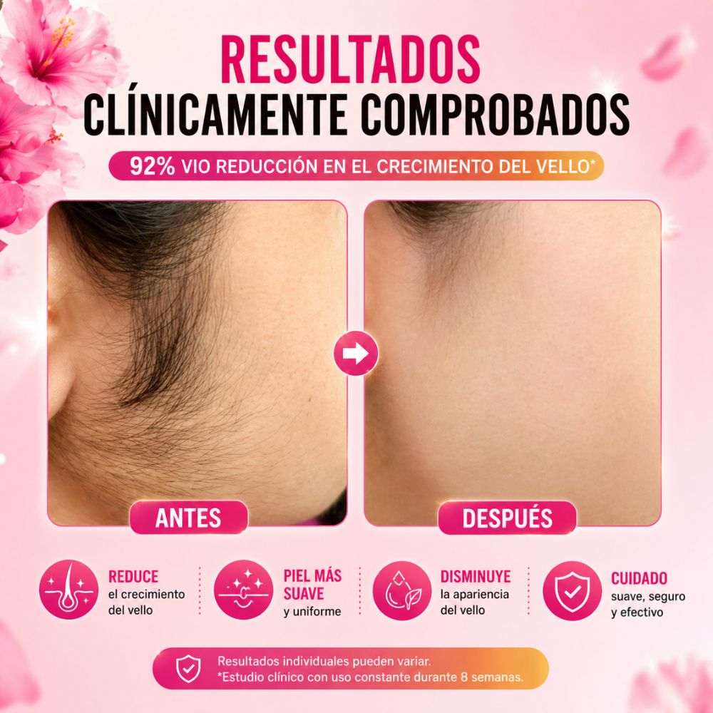 CYPERUS ROTUNDUS® 🍊 Serum Organico Eliminador de Vellos Permanentes🌿- Solo por hoy 40% de descuento 🚀