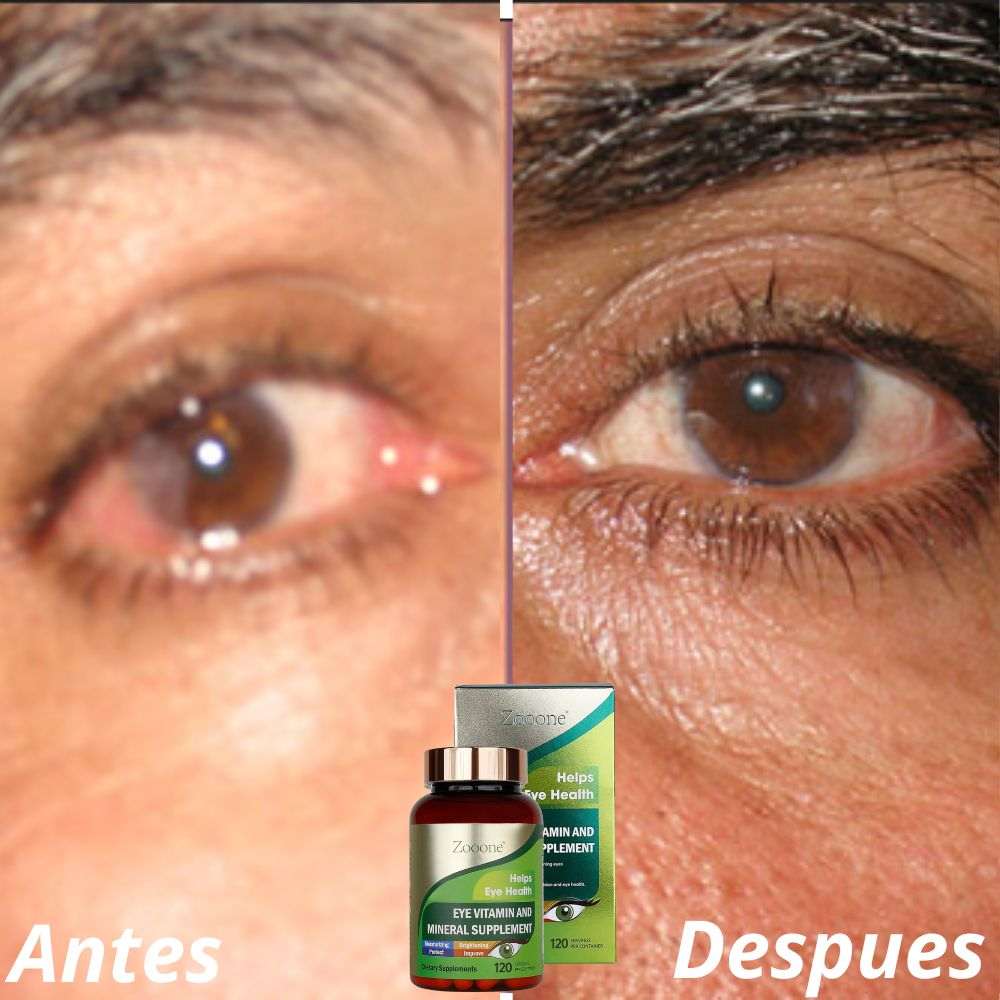 Zooone Luteina Suplementento para los ojos
