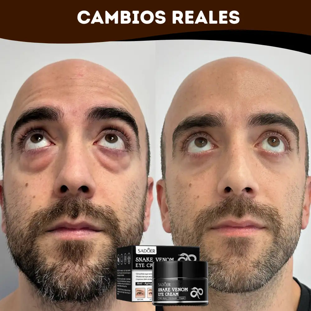 Crema Serpiente Syn-Ake® 💧👁️ Mirada fresca, rostro Joven