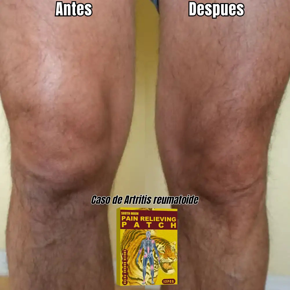 Parche del tigre