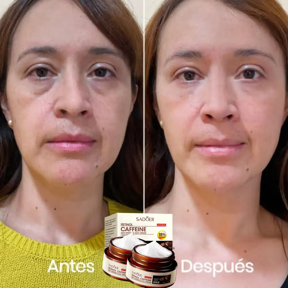 Coffe Eyes® Crema de cafeína - Mirada Fresca Joven y Descansada