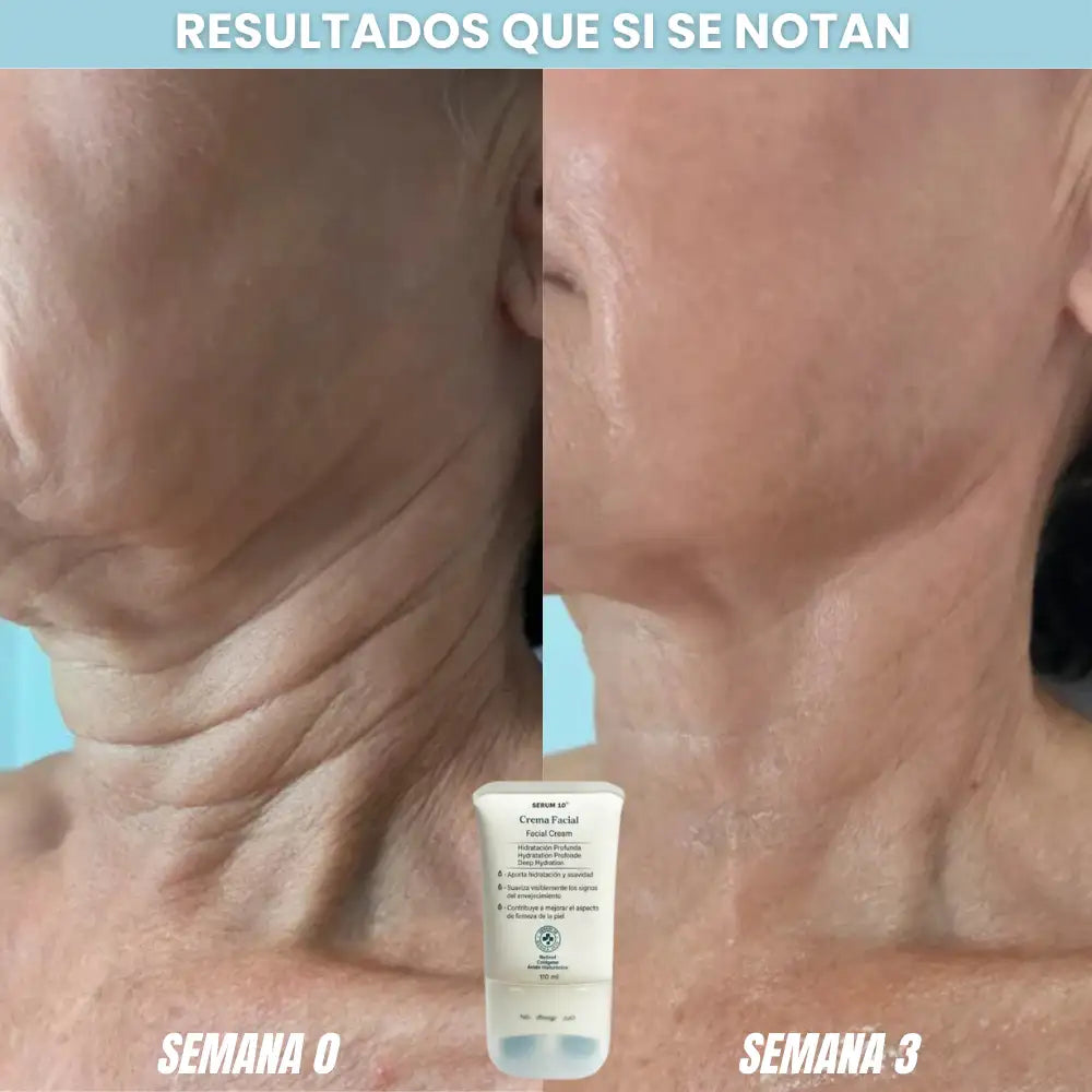 Serum 10 - Crema Masajeadora para el Cuello