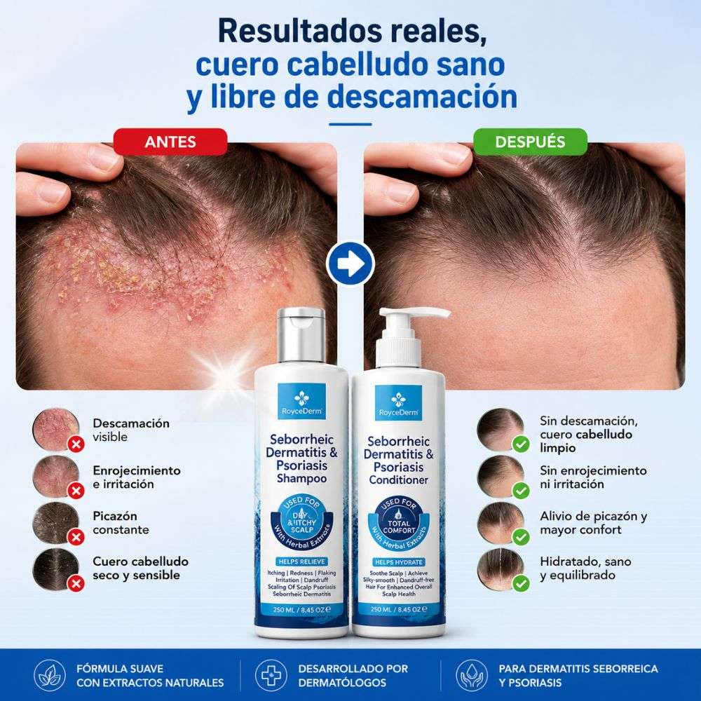 Combo Bioregenerativo de cuero cabelludo Roycederm Shampoo + Acondicionadora - Solo por hoy 30% de Descuento 🚀