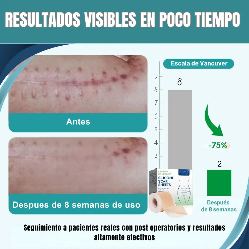 Silicone Scar Sheets® Cinta de Silicona Cicatrizante - Marcas invisibles, Piel Uniforme 🫆👣