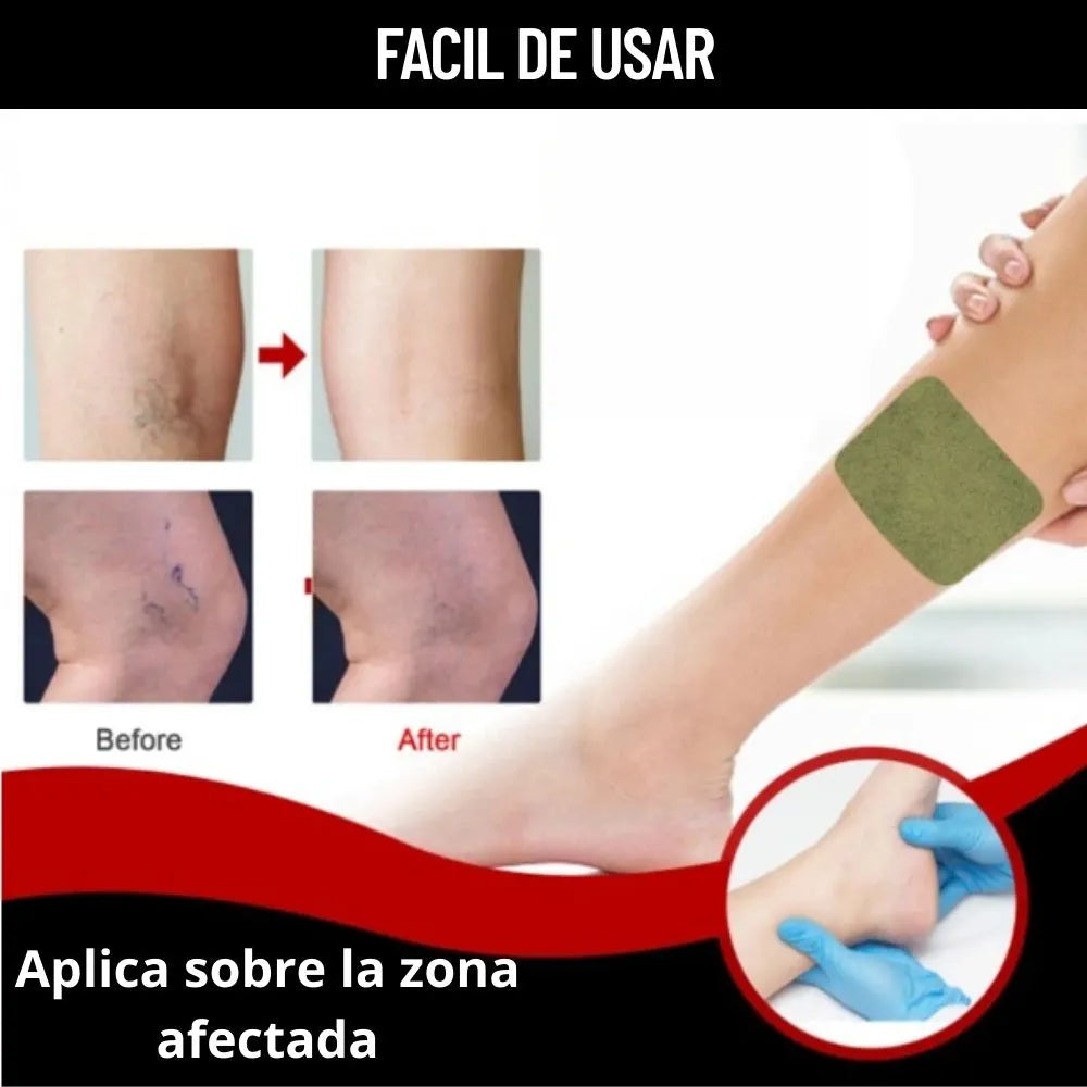 Parches Varicoce Veins® Lleva 2 Por el Precio de 1 (24 Unidades)