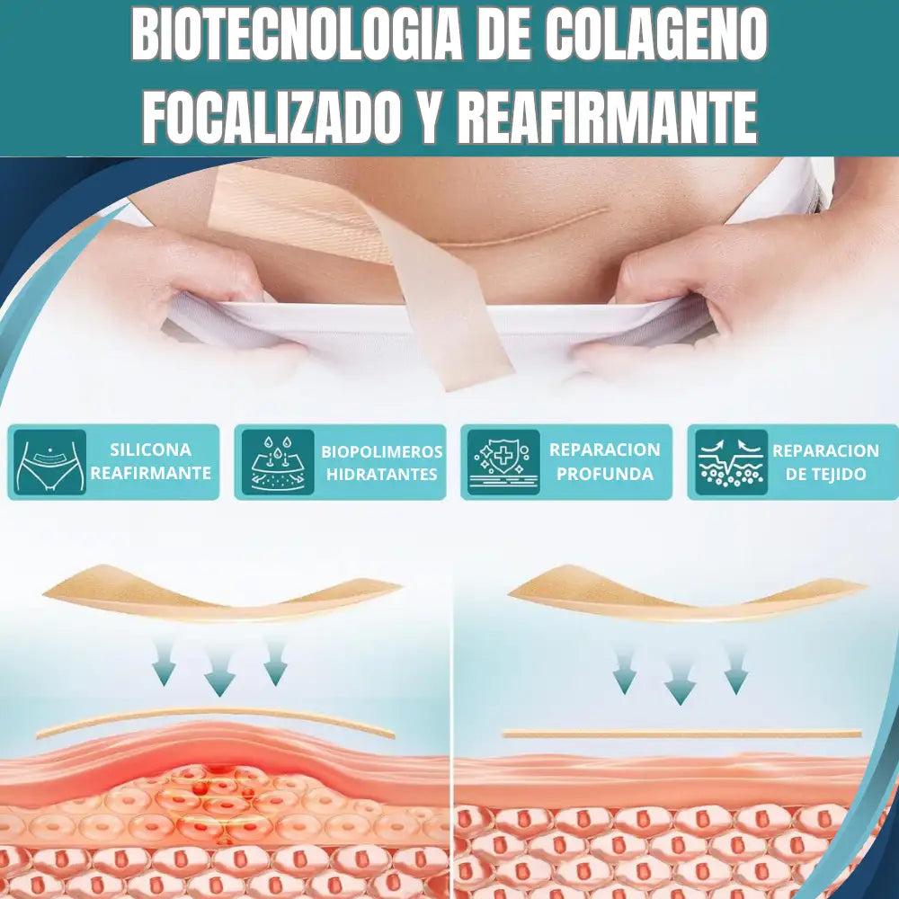 Silicone Scar Sheets® Cinta de Silicona Cicatrizante - Marcas invisibles, Piel Uniforme 🫆👣