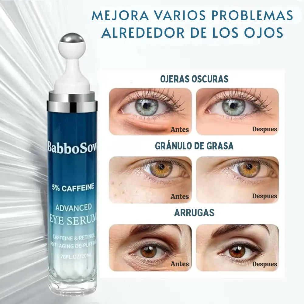 EyeLift® Serum de Cafeína – Mirada fresca, joven y descansada 👁️❄️