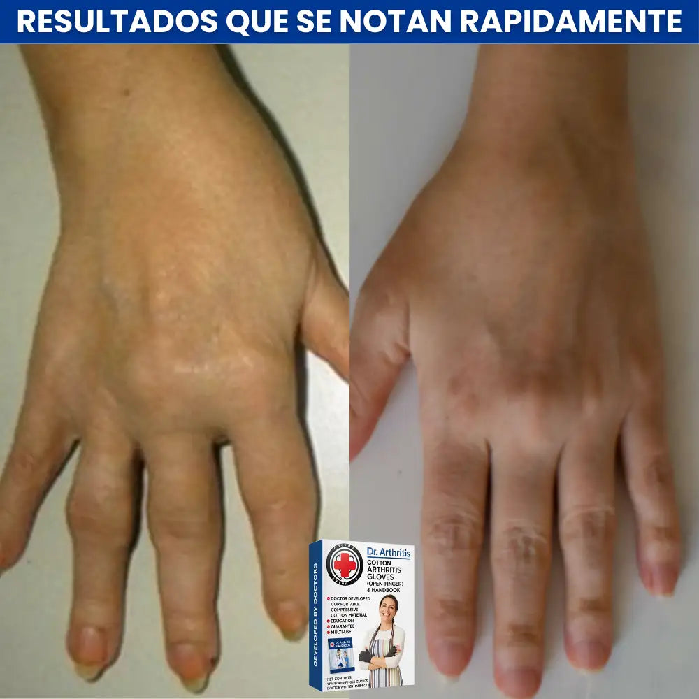 🌡️ ThermoFlex Gloves™🧤- Guantes de Compresión, movilidad y Calor Terapéutico ¡BlackFriday 40% Descuento!