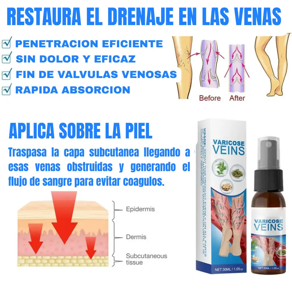 Spray Varicoce Veins® : Piernas mas sanas, Pasos mas firmes 🦵Paga 1 y Lleva 2 ¡Super Oferta SOLO POR HOY 🚀 40% de Descuento!