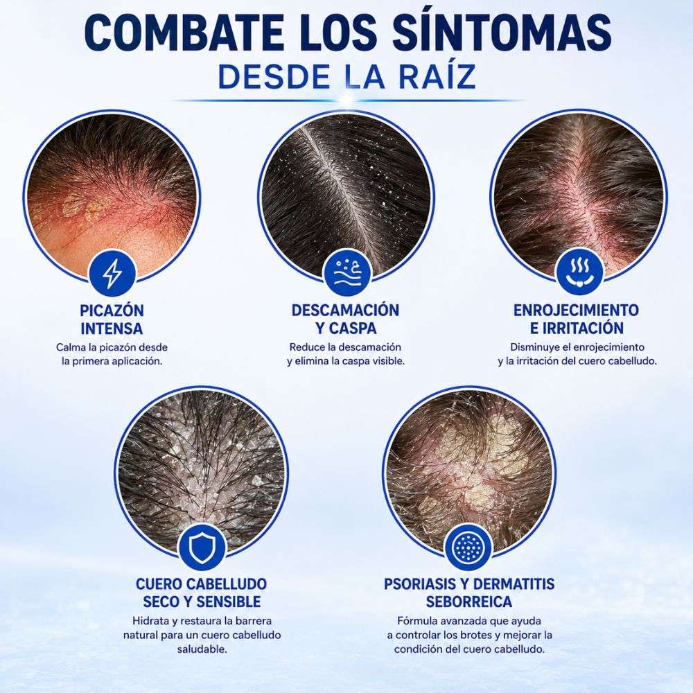 Combo Bioregenerativo de cuero cabelludo Roycederm Shampoo + Acondicionadora - Solo por hoy 30% de Descuento 🚀