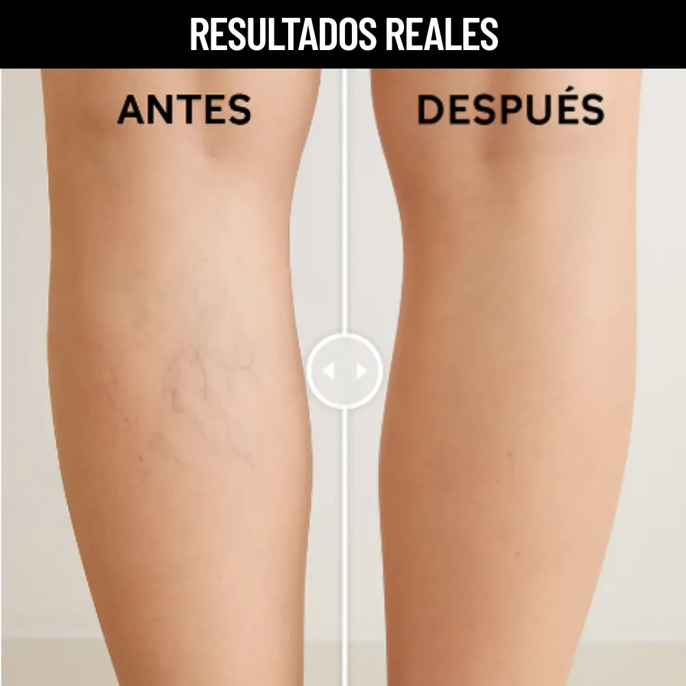 Parches Varicoce Veins® Lleva 2 Por el Precio de 1 (24 Unidades)