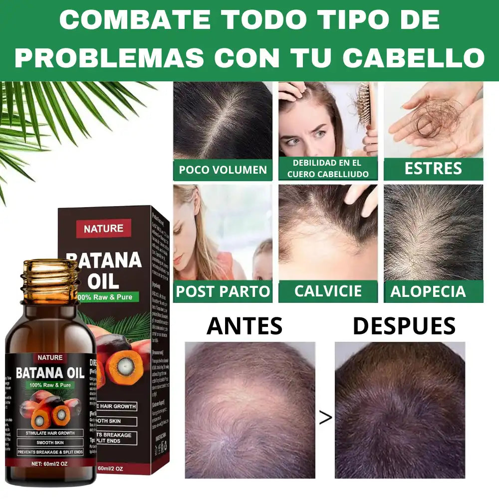 Batana Oil® Aceite de Batana 🥭 - Recupera tu cabello y detén la caída desde la raíz + Shampoo Acelerador de Crecimiento de Regalo  🎁